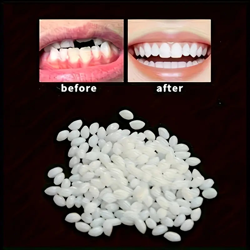 Teeth Gap Filler
